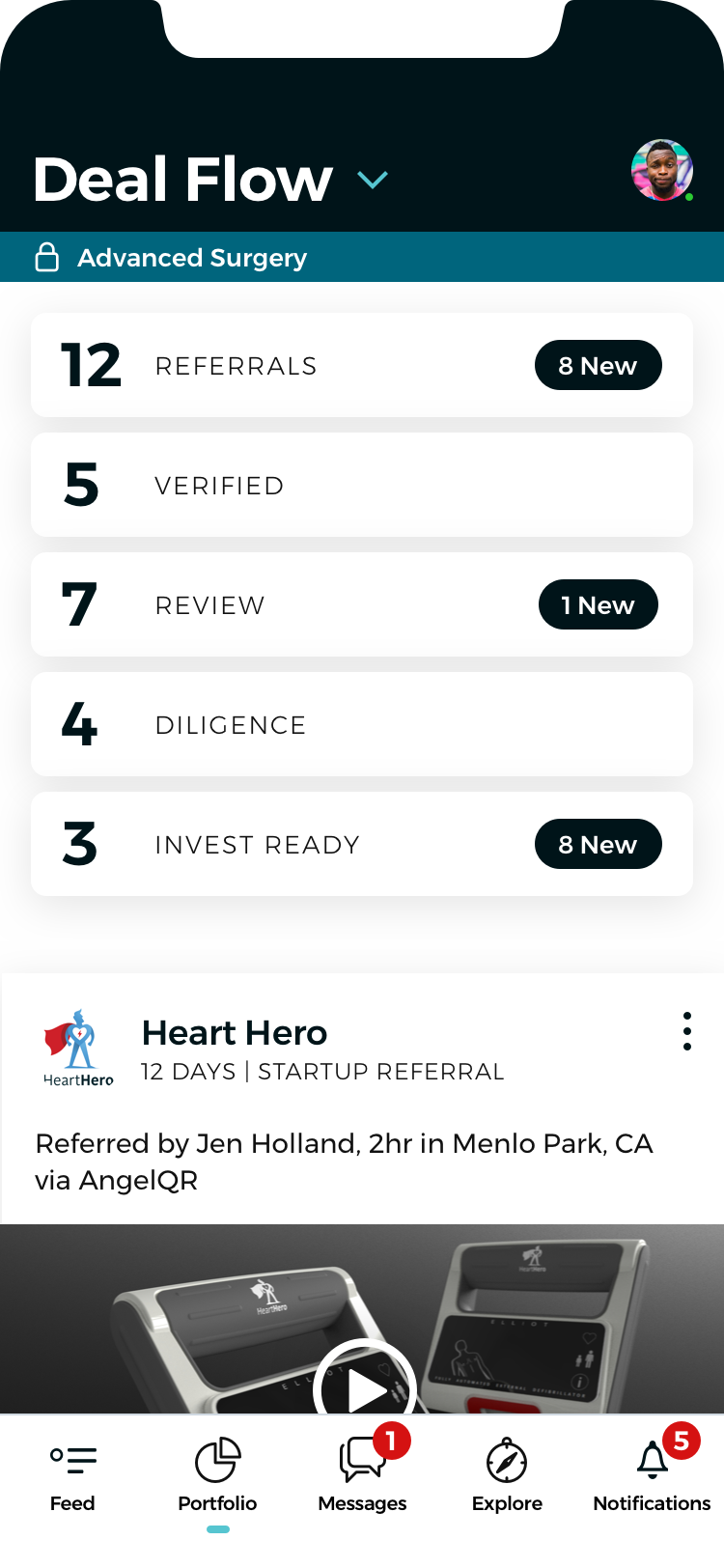Mobile deal flow — pipeline stages